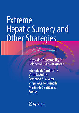 Couverture cartonnée Extreme Hepatic Surgery and Other Strategies de 