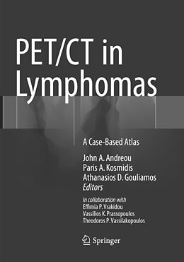 Couverture cartonnée PET/CT in Lymphomas de 