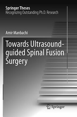 Kartonierter Einband Towards Ultrasound-guided Spinal Fusion Surgery von Amir Manbachi