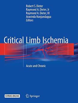 Couverture cartonnée Critical Limb Ischemia de 