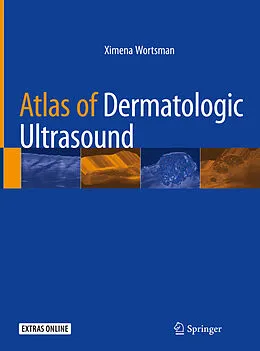 E-Book (pdf) Atlas of Dermatologic Ultrasound von Ximena Wortsman