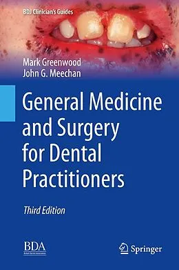 E-Book (pdf) General Medicine and Surgery for Dental Practitioners von Mark Greenwood, John G. Meechan