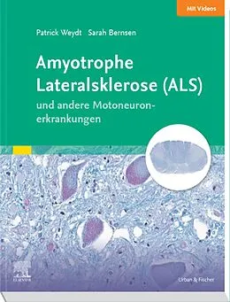E-Book (epub) Amyotrophe Lateralsklerose (ALS) und andere Motoneuronerkrankungen von Patrick Weydt, Sarah Bernsen, Johannes Friese