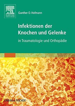 Kartonierter Einband Infektionen der Knochen und Gelenke von Gunther O. Hofmann