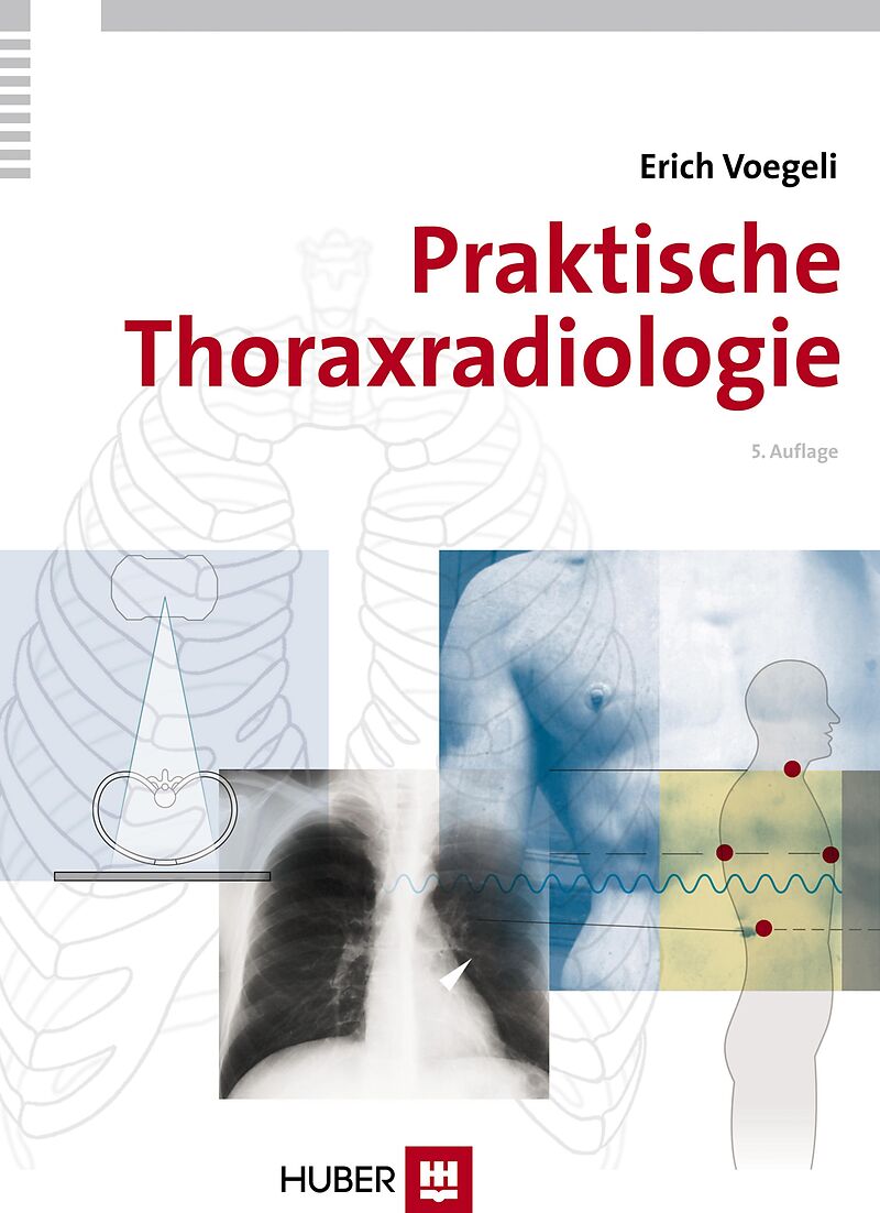 Praktische Thoraxradiologie Erich Voegeli Deutsche E Books Ex Libris