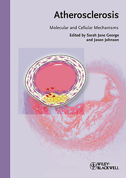 eBook (pdf) Atherosclerosis de 