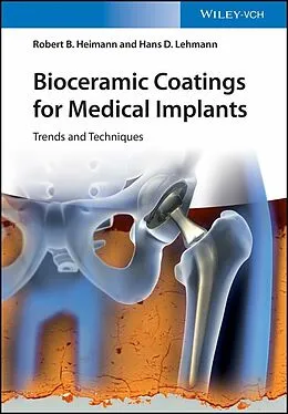 E-Book (epub) Bioceramic Coatings for Medical Implants von Robert B. Heimann, Hans D. Lehmann