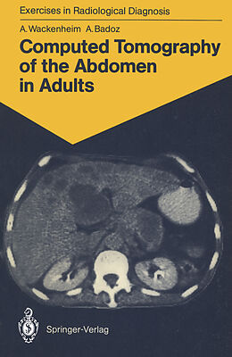 Kartonierter Einband Computed Tomography of the Abdomen in Adults von Auguste Wackenheim, Armelle Badoz
