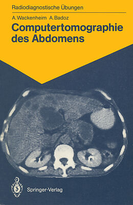 Kartonierter Einband Computertomographie des Abdomens von Auguste Wackenheim, Armelle Badoz