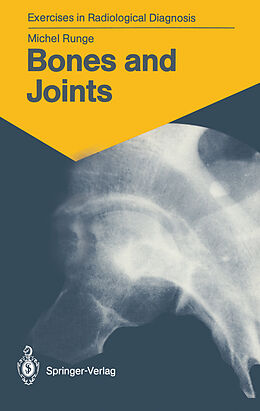 Kartonierter Einband Bones and Joints von Michel Runge