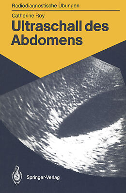 Kartonierter Einband Ultraschall des Abdomens von Catherine Roy