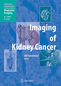 Fester Einband Imaging of Kidney Cancer von 