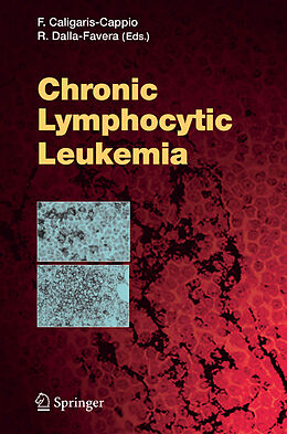 Fester Einband Chronic Lymphocytic Leukemia von 