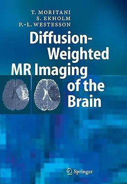 E-Book (pdf) Diffusion-Weighted MR Imaging of the Brain von T. Moritani, S. Ekholm, P. -L. Westesson