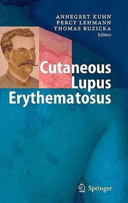 E-Book (pdf) Cutaneous Lupus Erythematosus von Annegret Kuhn, Percy Lehmann, Thomas Ruzicka
