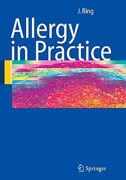 E-Book (pdf) Allergy in Practice von Johannes Ring