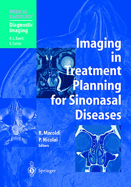 eBook (pdf) Imaging in Treatment Planning for Sinonasal Diseases de Roberto Maroldi, Piero Nicolai