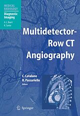 eBook (pdf) Multidetector-Row CT Angiography de Carlo Catalano, Roberto Passariello