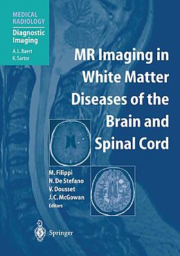 eBook (pdf) MR Imaging in White Matter Diseases of the Brain and Spinal Cord de 