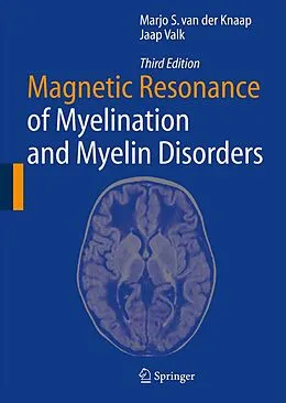 E-Book (pdf) Magnetic Resonance of Myelination and Myelin Disorders von Marjo S. Van Der Knaap, Jaap Valk