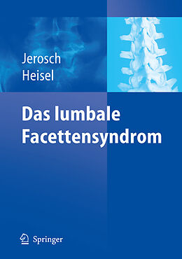Kartonierter Einband Das lumbale Facettensyndrom von Jörg Jerosch, Jürgen Heisel
