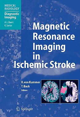 eBook (pdf) Magnetic Resonance Imaging in Ischemic Stroke de 