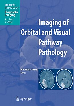 eBook (pdf) Imaging of Orbital and Visual Pathway Pathology de 