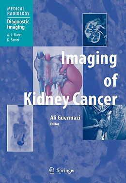 eBook (pdf) Imaging of Kidney Cancer de 