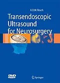 E-Book (pdf) Transendoscopic Ultrasound for Neurosurgery von Klaus Dieter Maria Resch