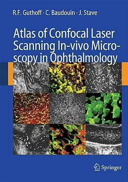 E-Book (pdf) Atlas of Confocal Laser Scanning In-vivo Microscopy in Ophthalmology von R. F. Guthoff, C. Baudouin, J. Stave