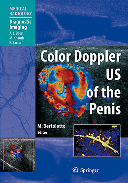 Fester Einband Color Doppler US of the Penis von 