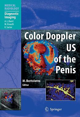 E-Book (pdf) Color Doppler US of the Penis von Michele Bertolotto
