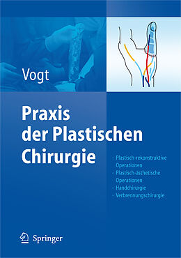 Fester Einband Praxis der Plastischen Chirurgie von Peter M Vogt