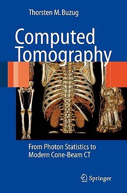 E-Book (pdf) Computed Tomography von Thorsten M. Buzug