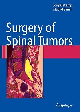 E-Book (pdf) Surgery of Spinal Tumors von Jörg Klekamp, Madjid Samii