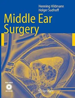 E-Book (pdf) Middle Ear Surgery von Henning Hildmann, Holger Sudhoff