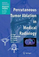 eBook (pdf) Percutaneous Tumor Ablation in Medical Radiology de Thomas J. Vogl, Thomas K. Helmberger, Martin G. Mack