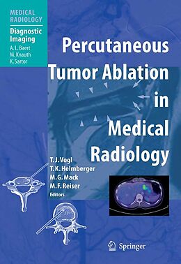 eBook (pdf) Percutaneous Tumor Ablation in Medical Radiology de Thomas J. Vogl, Thomas K. Helmberger, Martin G. Mack