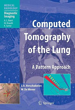 E-Book (pdf) Computed Tomography of the Lung von Johny A. Verschakelen, Walter De Wever