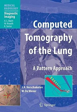 E-Book (pdf) Computed Tomography of the Lung von Johny A. Verschakelen, Walter De Wever