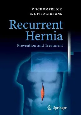 E-Book (pdf) Recurrent Hernia von Volker Schumpelick, Robert J. Fitzgibbons