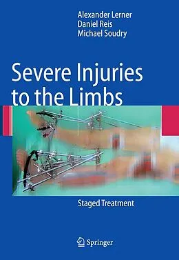 E-Book (pdf) Severe Injuries to the Limbs von Alexander Lerner, Daniel Reis, Michael Soudry