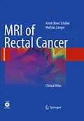 E-Book (pdf) MRI of Rectal Cancer von Arnd-Oliver Schäfer, Mathias Langer