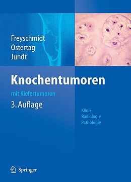 E-Book (pdf) Knochentumoren mit Kiefertumoren von Jürgen Freyschmidt, Helmut Ostertag, Gernot Jundt