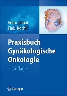 E-Book (pdf) Praxisbuch Gynäkologische Onkologie von Edgar Petru, Walter Jonat, Daniel Fink