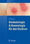 E-Book (pdf) Dermatologie und Venerologie für das Studium von Peter Fritsch