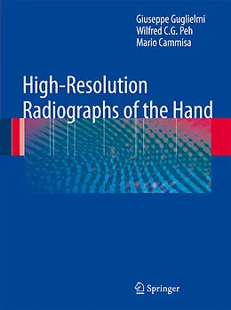 E-Book (pdf) High-Resolution Radiographs of the Hand von Giuseppe Guglielmi, Wilfred C. G. Peh, Mario Cammisa