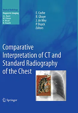 E-Book (pdf) Comparative Interpretation of CT and Standard Radiography of the Chest von Emmanuel E. Coche, Benoit Ghaye, Johan Mey
