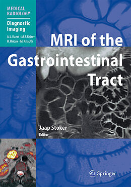 Livre Relié MRI of the Gastrointestinal Tract de 