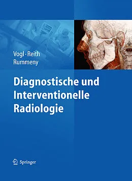 E-Book (pdf) Diagnostische und interventionelle Radiologie von Ernst J. Rummeny, Wolfgang Reith, Thomas J. Vogl
